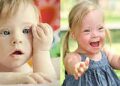 Để biết con có mắc hội chứng Down không, mẹ có thể làm những việc này